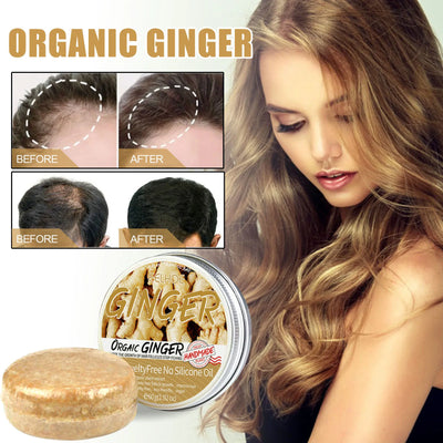 OrganicRoots - Ginger Hair Regrowth Shampoo Bar™