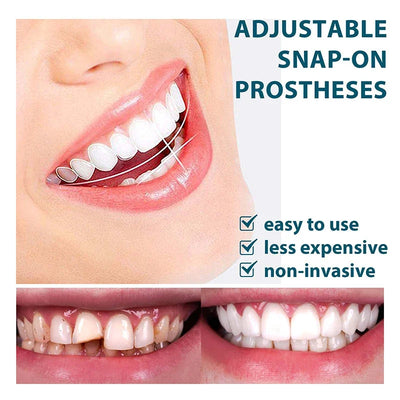 NewSmile - Snap-On Dentures™