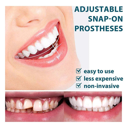 NewSmile - Snap-On Dentures™