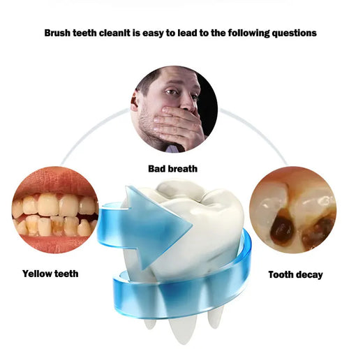 SmartSmile ™ Brush