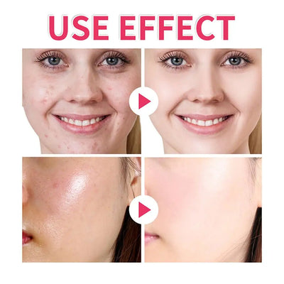 GlowBright  - Turmeric Pads™