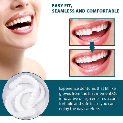 NewSmile - Snap-On Dentures™