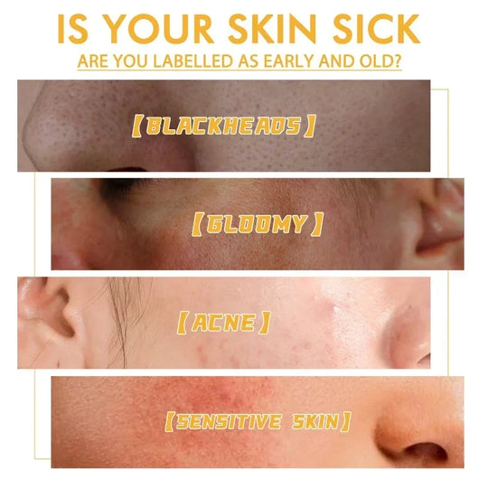 The Viral FreshFace - Honey Tearing Mask™
