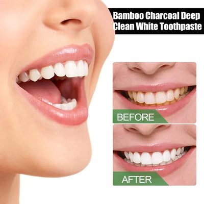 SparkleFresh - Bamboo Charcoal Whitening Toothpaste™