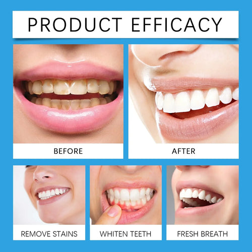 WhiteSimple - Teeth Whitening Powder™