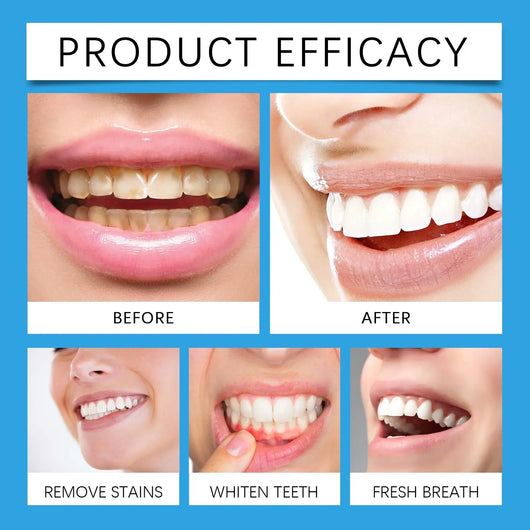 WhiteSimple - Teeth Whitening Powder™