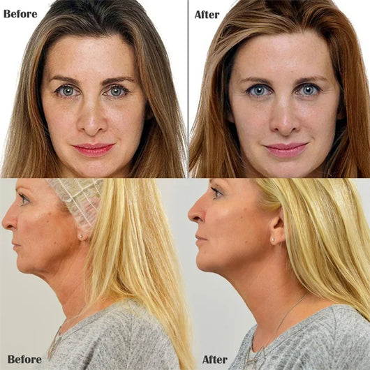 COLLAGEN THREAD WITH 24K GOLD SERUM™
