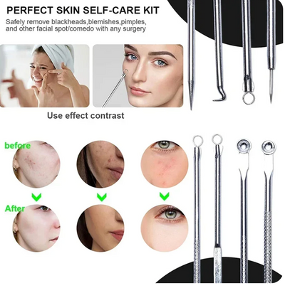 Ultra-Fine -Acne Blackhead Removal Kit™
