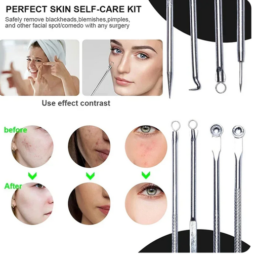 Ultra-Fine -Acne Blackhead Removal Kit™