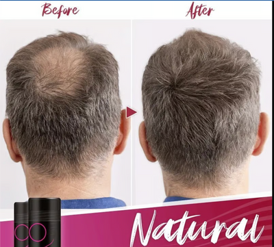Convrix  Secret Hair Fiber Powder Last Day 49 OFF™