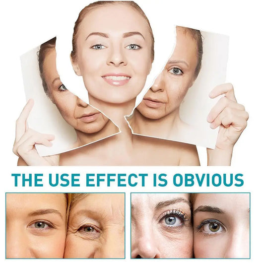 LAST DAY 70 OFFBotox Boost Anti-Aging Serum™