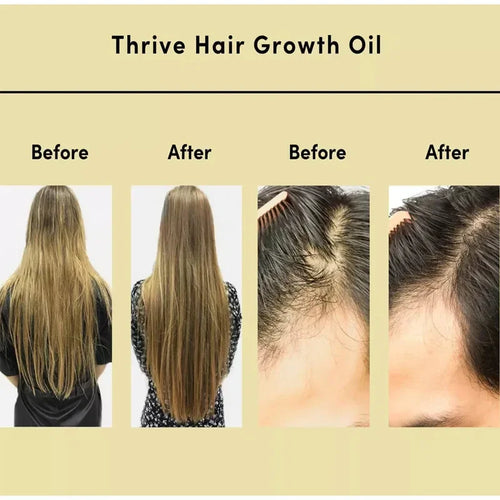 Bobbasow  Natural Hair Growth Oil™