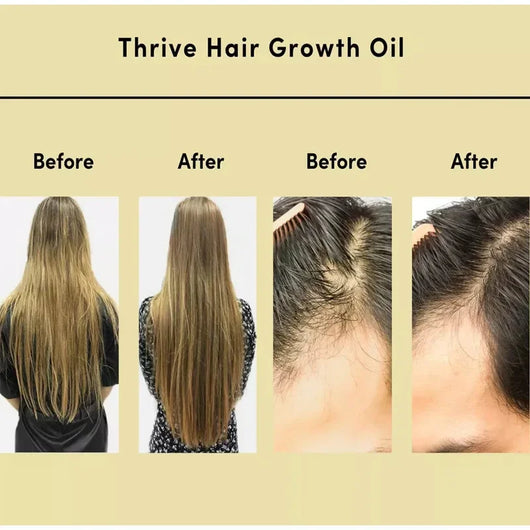 Bobbasow  Natural Hair Growth Oil™