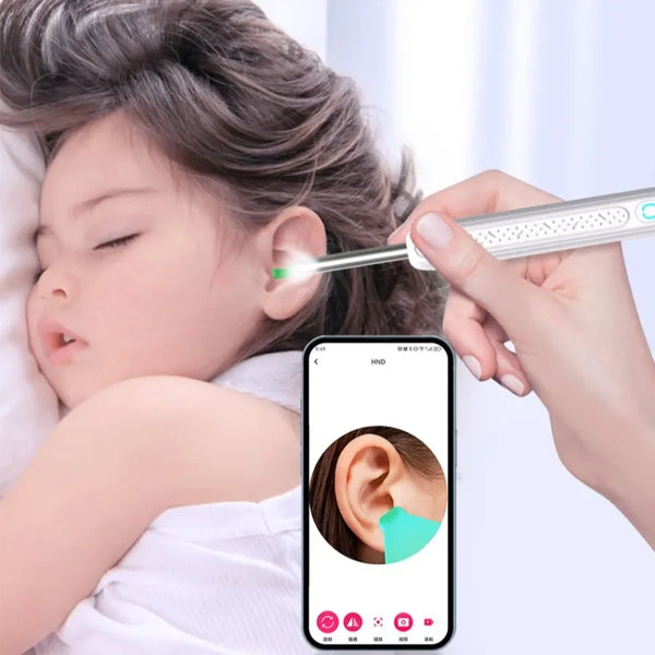SmartEar ™