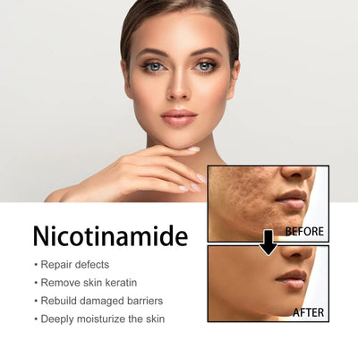 Last Day Promotion 64 OFF-Niacinamide Facial Essence™