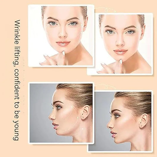 Last Day 70 OFFInvisible Face Lifter TapeHas a delicate V face 120pcs™