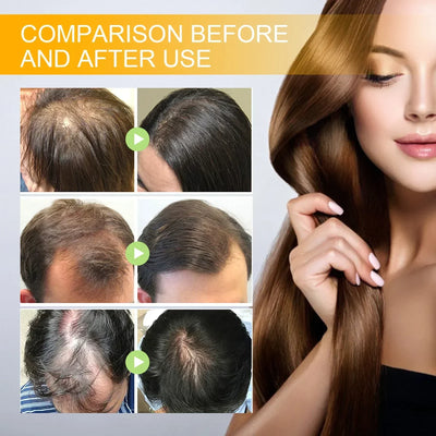 LAST DAY SALE-80 OFF Moonbiffy Biotin Premium Hair Growth Serum™