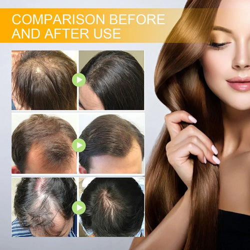 LAST DAY SALE-80 OFF Moonbiffy Biotin Premium Hair Growth Serum™