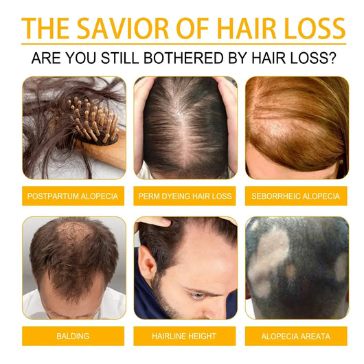 LAST DAY SALE-80 OFF Moonbiffy Biotin Premium Hair Growth Serum™