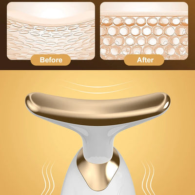 GlowLift  - 7-in-1 LED Facial Sculptor™