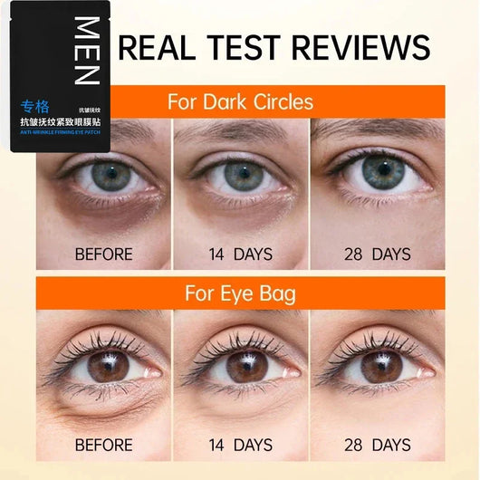 RadiantEyes - Eye Bags Removal Patch™