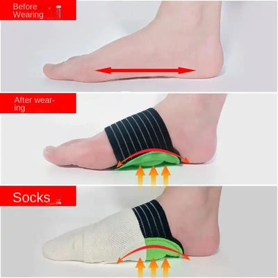 ArchAid - Rubbing Insoles™
