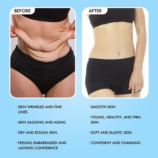 LuxeLift  Skin Firming Youth Butter™