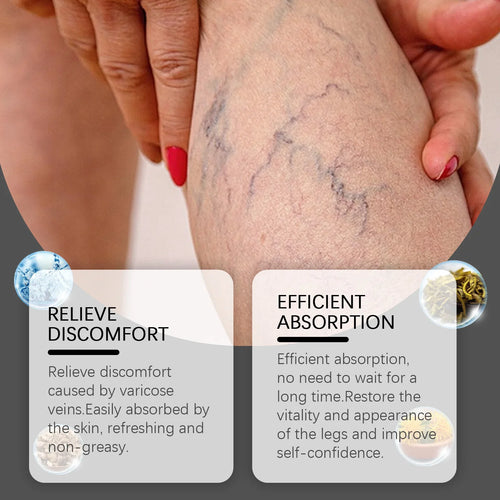 VeinRelief™ Varicose Veins Solution