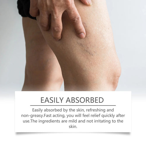 VeinRelief™ Varicose Veins Solution