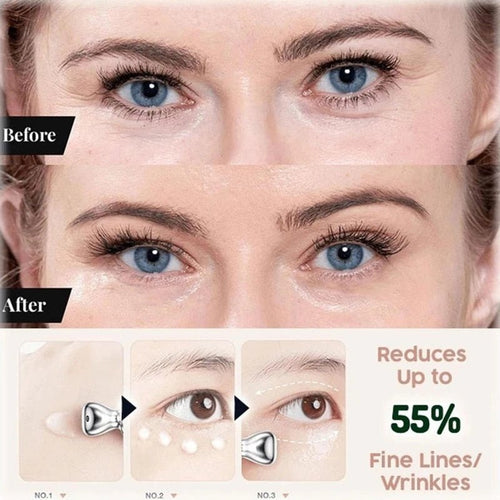Anti-Wrinkle Eye Cream™