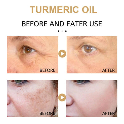 AntiAging ™ - Turmeric Dark Spot Corrector Serum - TumTum