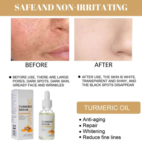 AntiAging  - Turmeric Dark Spot Corrector Serum™