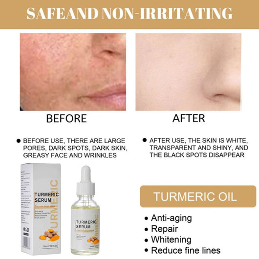 AntiAging ™ - Turmeric Dark Spot Corrector Serum - TumTum