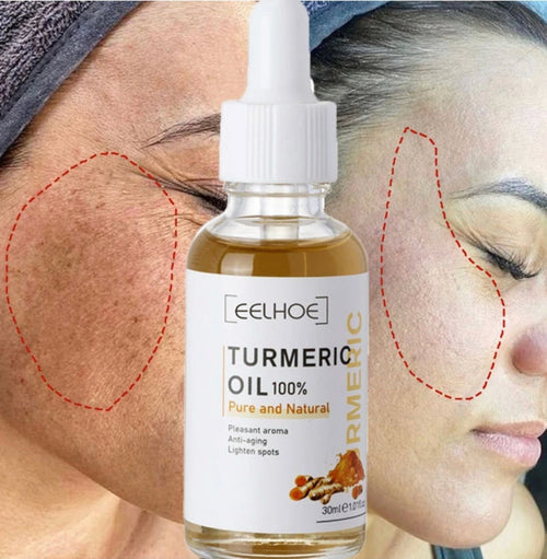 AntiAging  - Turmeric Dark Spot Corrector Serum™