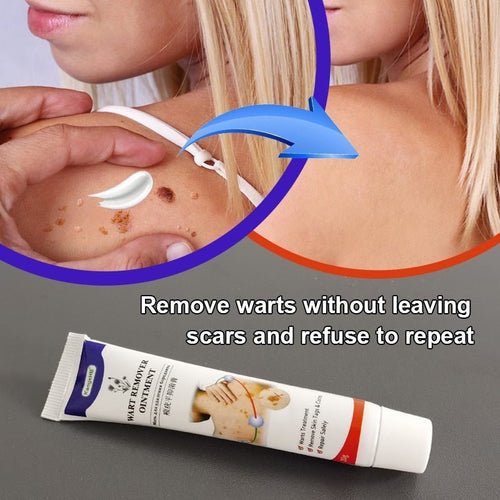 AntiWart - Painless Warts Solution™