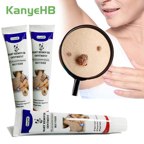 AntiWart - Painless Warts Solution™