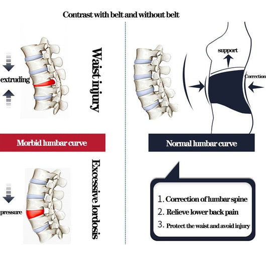 Back Support Belt™ - TumTum