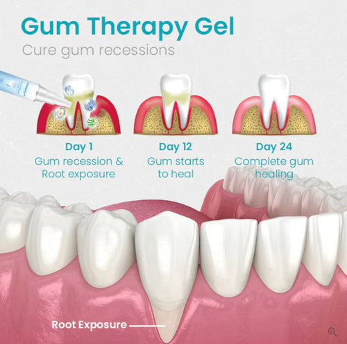 Ceoerty Gum Shield Therapy Gel™