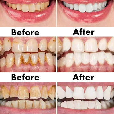 Ceoerty™ Gum Shield Therapy Gel - TumTum