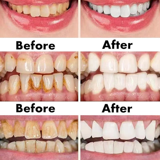 Ceoerty™ Gum Shield Therapy Gel - TumTum
