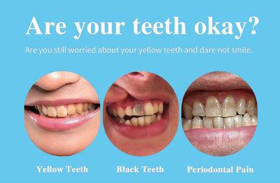 Ceoerty™ Gum Shield Therapy Gel - TumTum