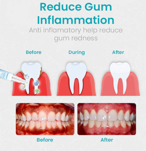Ceoerty Gum Shield Therapy Gel™