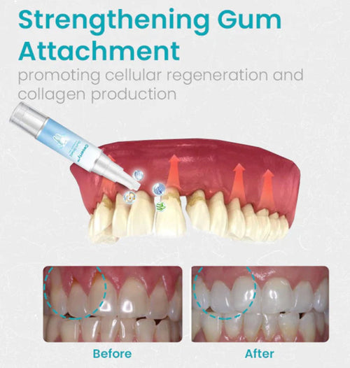 Ceoerty Gum Shield Therapy Gel™