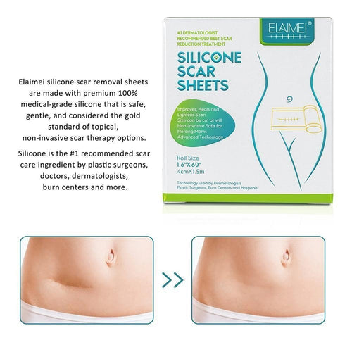 ELAIMEI Medical Soft Silicone Gel Tape for Scar Removal 16 x 60™