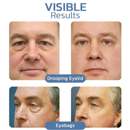 PeptiGel ™ - Eye Lift Cream - TumTum