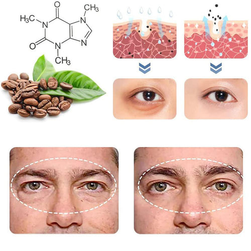 PeptiGel  - Eye Lift Cream™