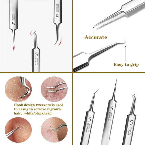 Tweezer Kit 3PcsBox™