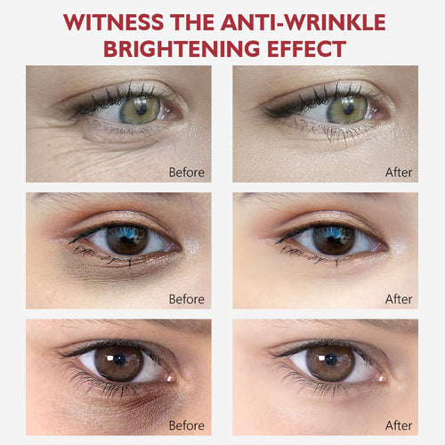 Retinol Anti-Aging Cream Buy 1 Get 1 Free™