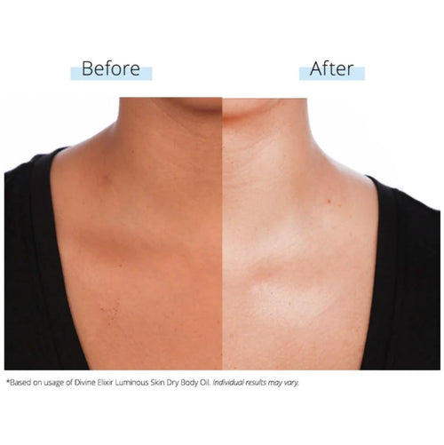 SkinFerm - Collagen Milk Whitening Soap™