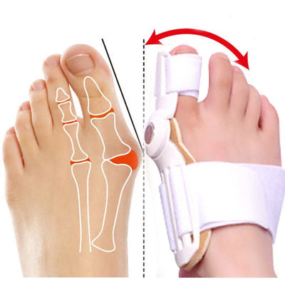 ToeCorrector™ - Flexible Orthopaedic Bunion Corrector - TumTum